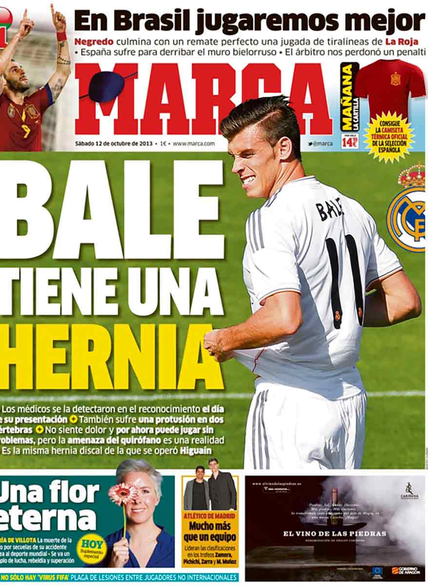 Bale tiene una hernia Marca