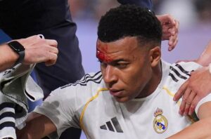 Sí, fue sangrante. Todo