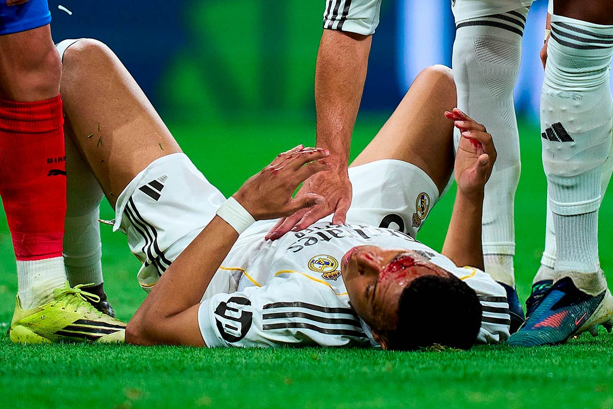 Las notas del Real Madrid - Girona